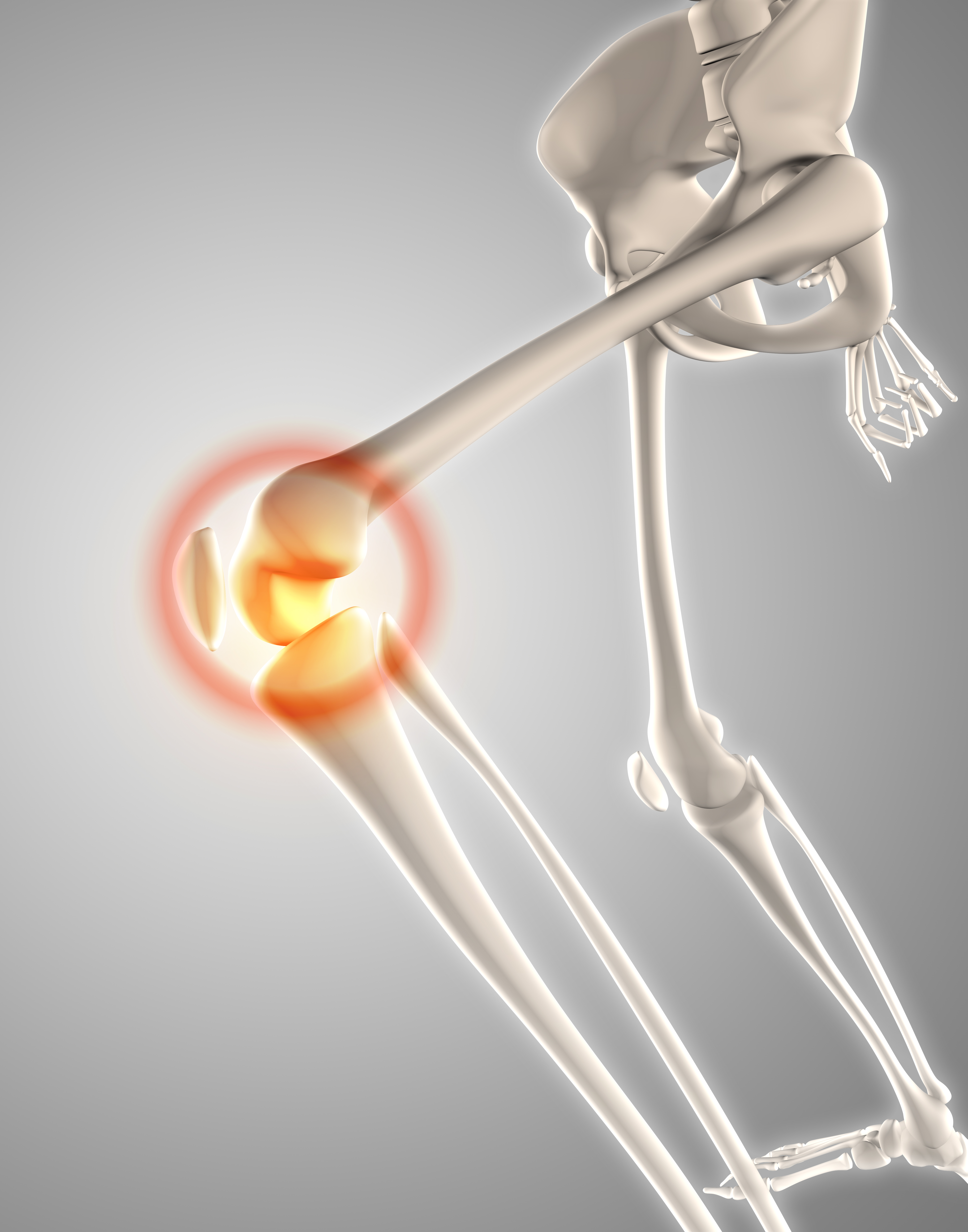 Orthopédie